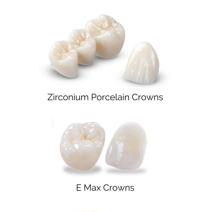 Zirconium Porcelain-Metal Silver Goldden Crowns 1 in Mota Varachha Surat