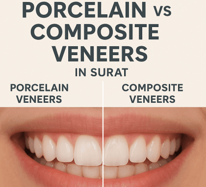 Porcelain vs Composite Veneers: Which is Best for Your Smile in Surat?